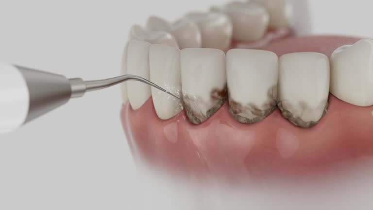 Reliable Emergency Dentist contractor in Glasgow, KY by Smile Center Dentistry